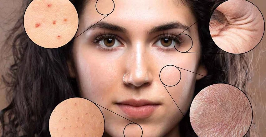 Natural Radiance with Ayurveda
