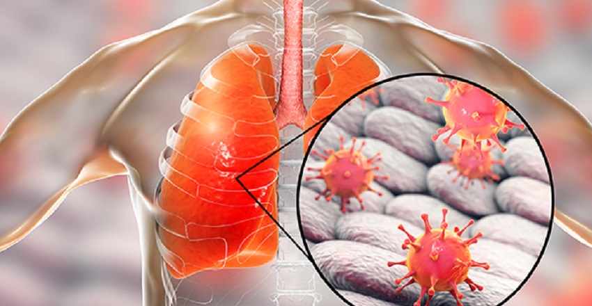 Dry Cough due to H3N2 Virus: Ayurveda’s Healing Approach