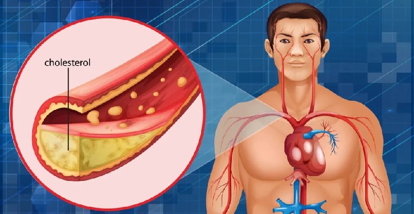 Cholesterol: The Most Misunderstood Friend of the Body
